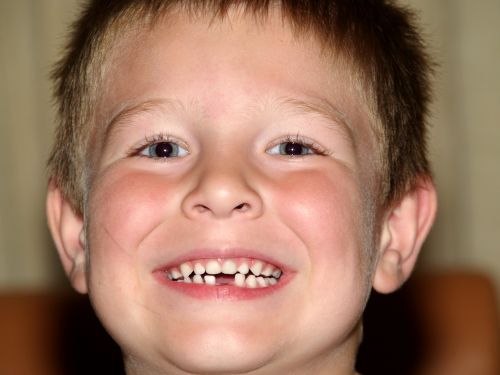 Сколько молочных зубов у человека?